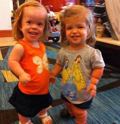 Paley研究院关于软骨发育不全治疗